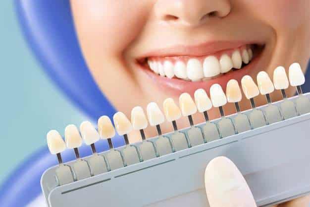 các phương pháp tẩy trắng răng nào & cách tẩy trắng răng nào là tốt nhất?