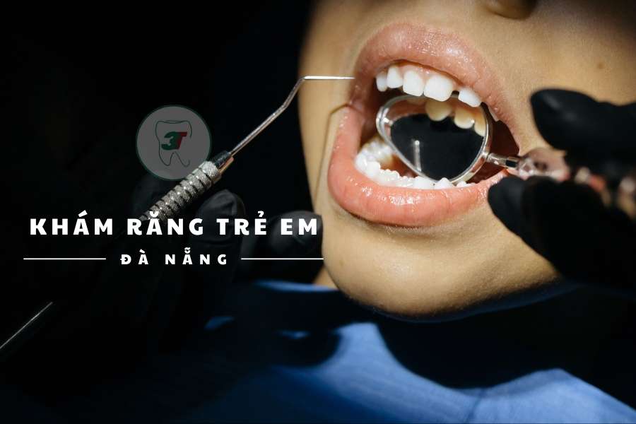 Khám răng trẻ em Đà Nẵng