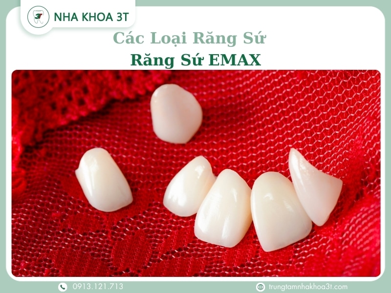Các loại răng sứ - Răng sứ Emax