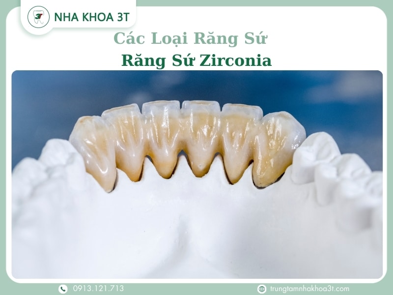Các loại răng sứ - Răng sứ Zirconia