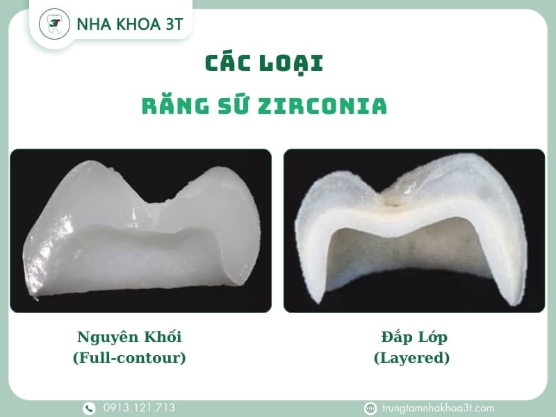 Các loại răng sứ Zirconia