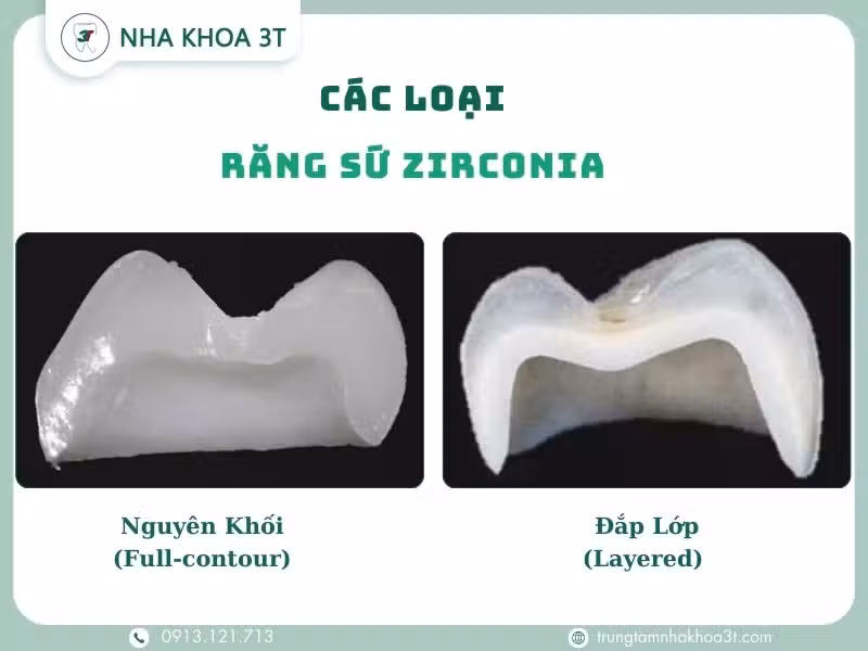 Răng toàn sứ Zirconia