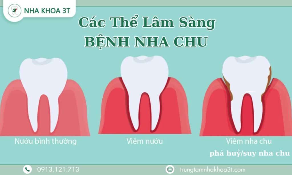 Cac the lam sang benh nha chu
