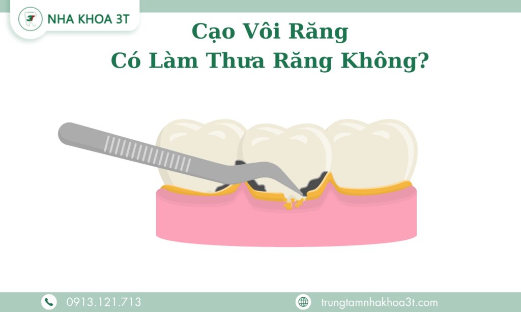 Cao Voi Rang Co Lam Thua Rang Khong