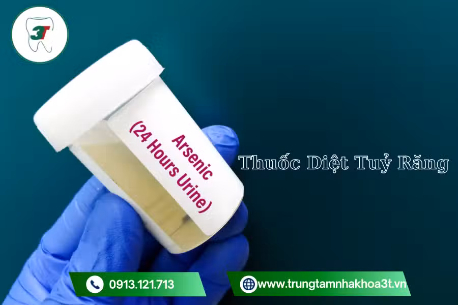 Hiểu rõ về đặt thuốc diệt tủy răng