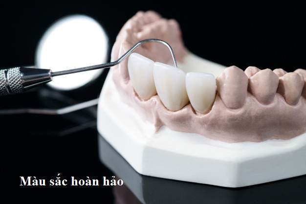 demonstration teeth model varieties prosthodontic bracket brace 60829 399 3