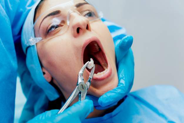 Bảo hiểm y tế nhổ răng được không?