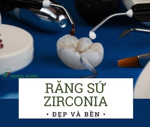 Răng Sứ Zirconia Có Tốt Không