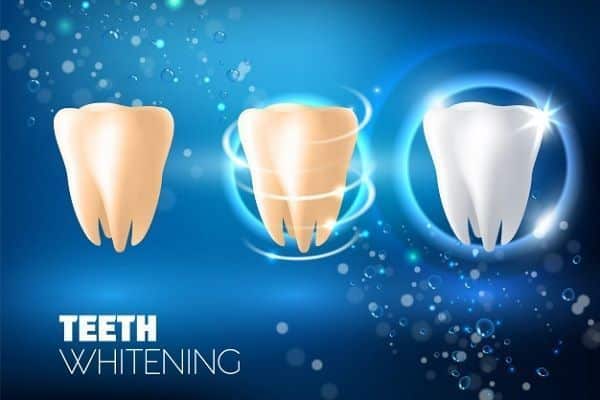 teeth whitening ad vector realistic illustration 103044 486