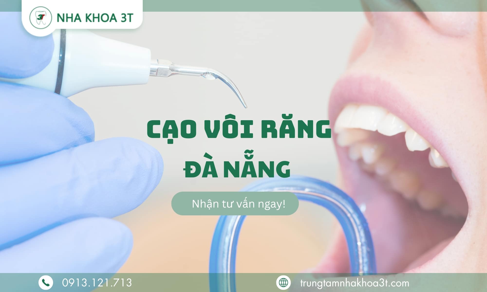 Tìm hiểu về dịch vụ cạo vôi răng tại Đà Nẵng