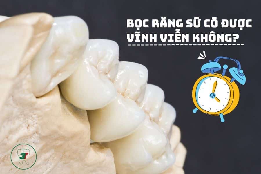 Boc Rang Su Co Duoc Vinh Vien Khong