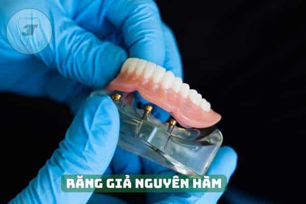răng giả nguyên hàm trên Implant