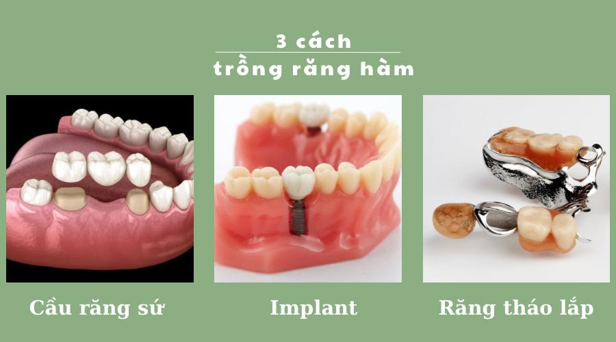 3 cách trồng răng cấm