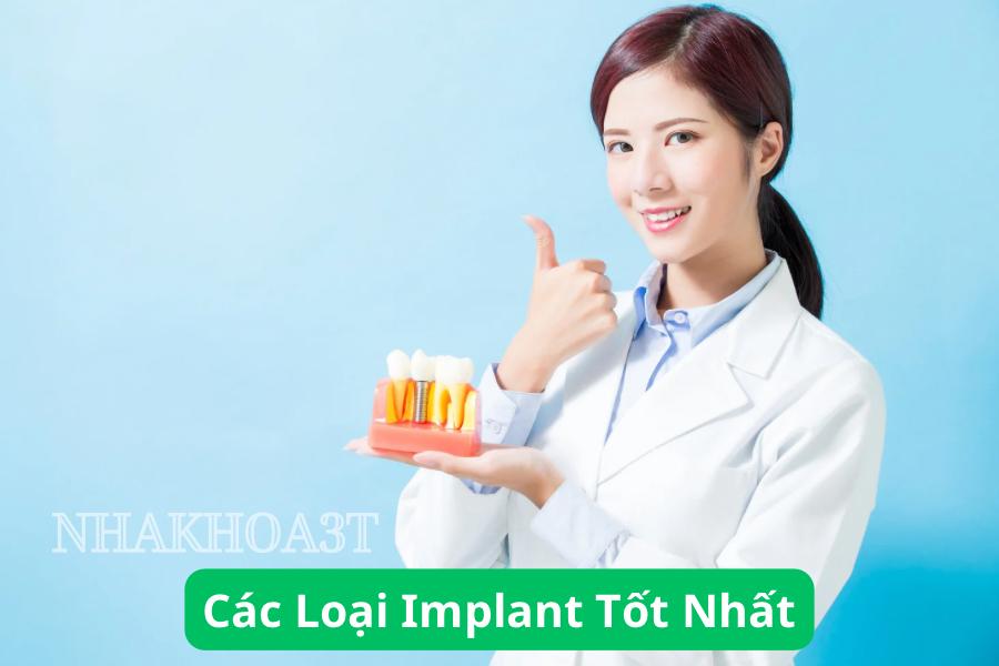 top 10 cac loai Implant tot nhat hien nay