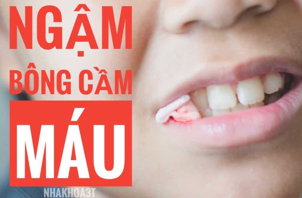 ngậm bông cầm máu