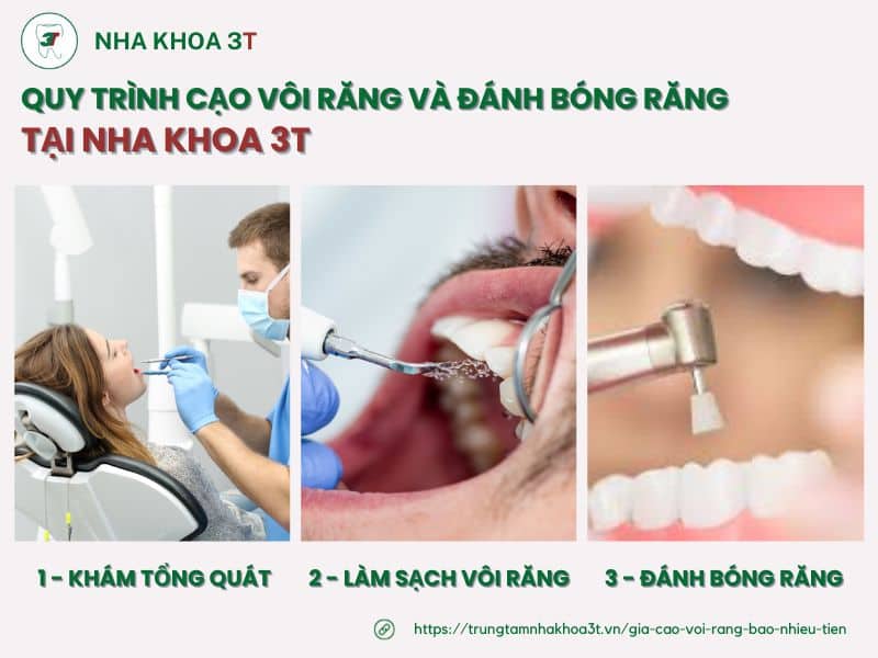 Quy trình cạo vôi răng tại Nha Khoa 3T