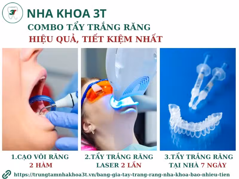 Phương pháp kết hợp (tương tự gói COMBO tại Nha Khoa 3T)