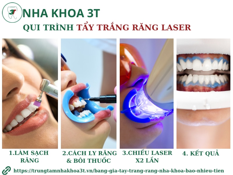 Quy trình tẩy trắng răng tại Nha Khoa 3T