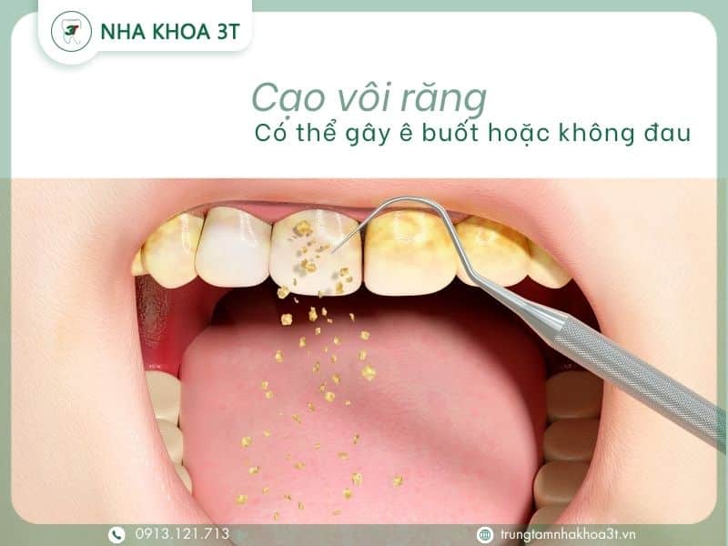 CAO VOI RANG CO DAU KHONG 6