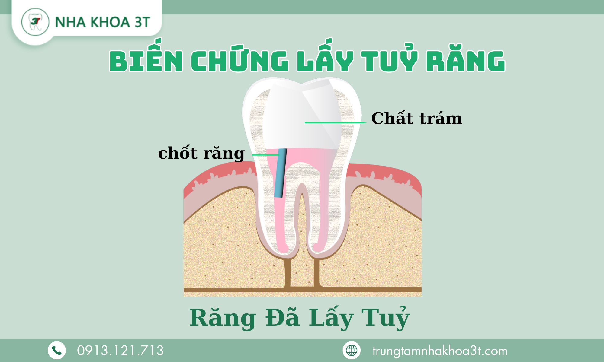Bien Chung Lay Tuy Rang
