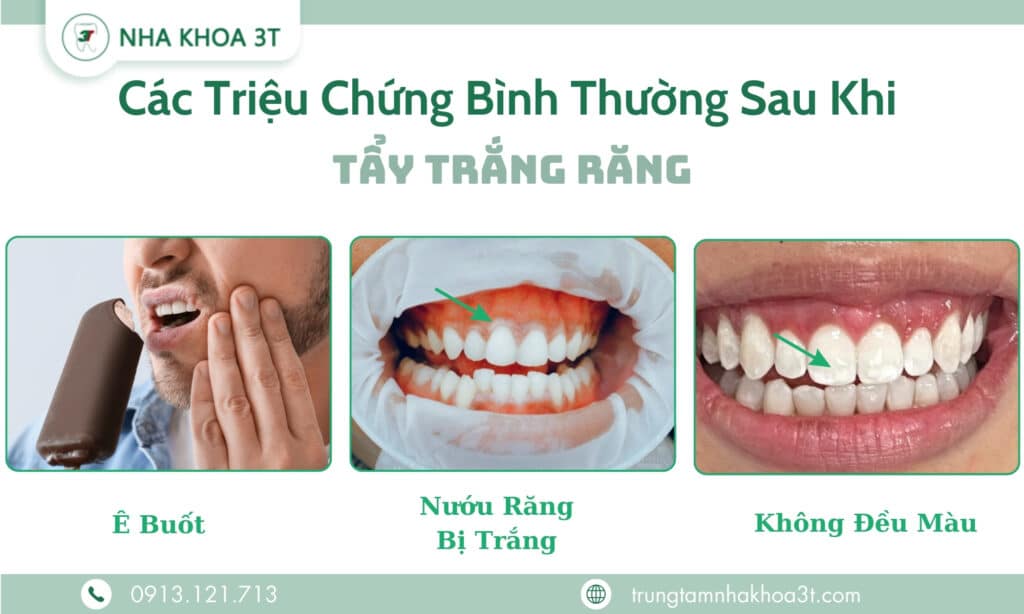 Cac Trieu Chung Binh Thuong Sau Khi Tay Trang Rang