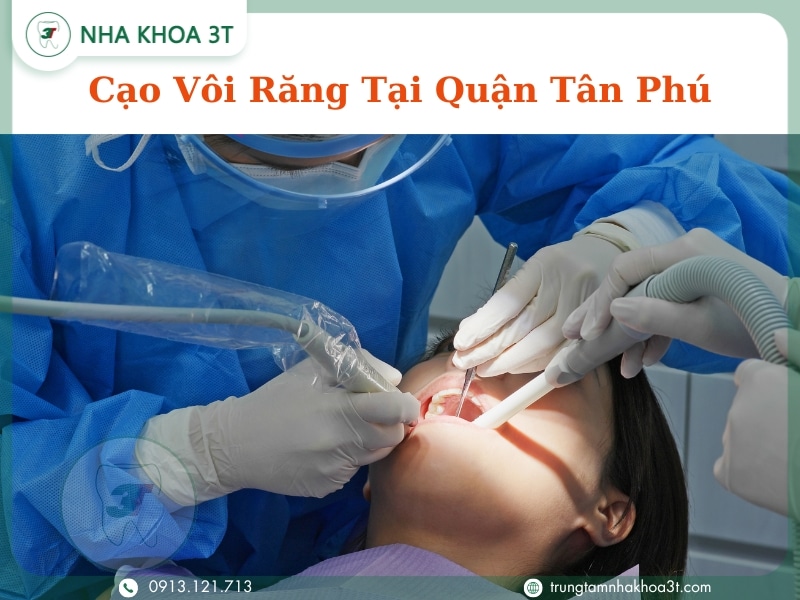 Cạo Vôi Răng Tại Quận Tân Phú